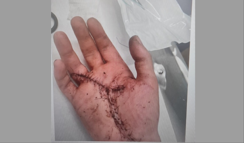 פציעה מדקירת סכין על רקע ויכוח בדרך, צילום משטרת ישראל